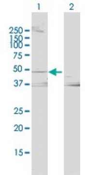 Anti-LCAT antibody produced in rabbit