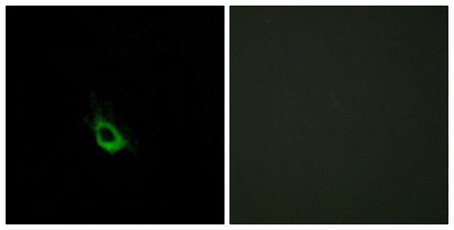 Anti-CARD10 antibody produced in rabbit