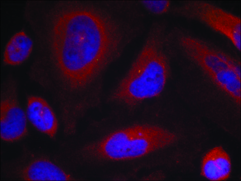 Anti-phospho-SYT1 (pSer³??) antibody produced in