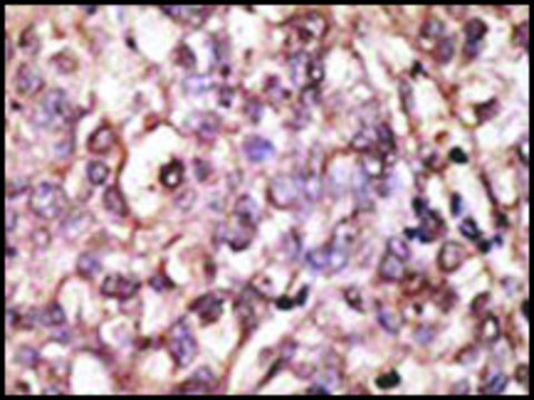 Anti-DKK4 (N-term) antibody produced in