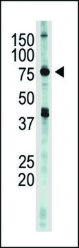 ANTI-IKK EPSILON (IKKE)(C-TERMINAL) antibody produced