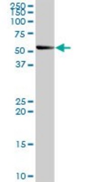 Anti-SMPDL3B antibody produced in rabbit