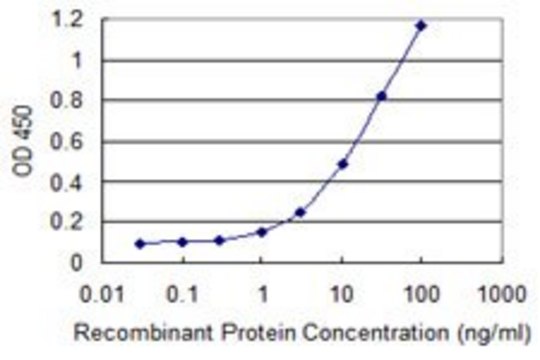 Monoclonal Anti-SHFM3P1 antibody produced in