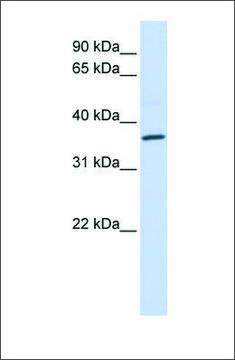 Anti-CCR5 antibody produced in rabbit