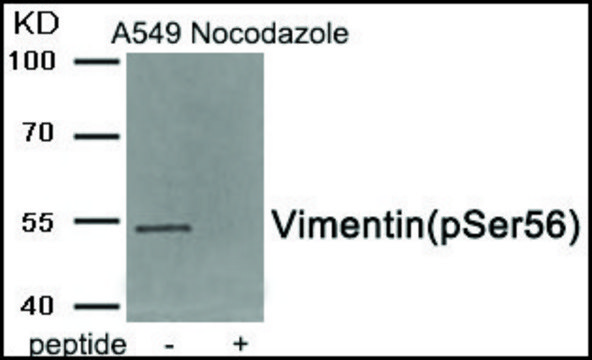 Anti-phospho-Vimentin (pSer??) antibody produced in