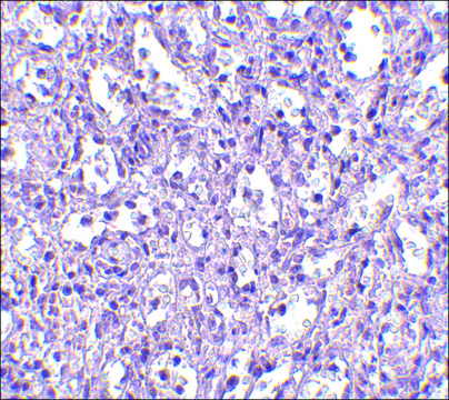 Anti-Carabin (ab1) antibody produced in
