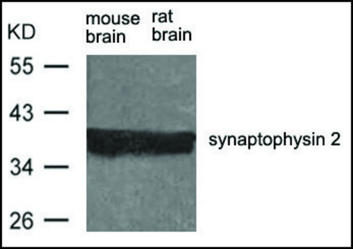 Anti-Synpr antibody produced in rabbit