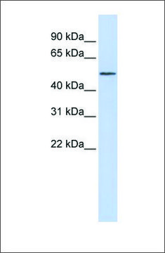 Anti-RORA (ab1) antibody produced in