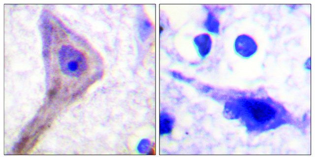Anti-AKT1 S1 antibody produced in