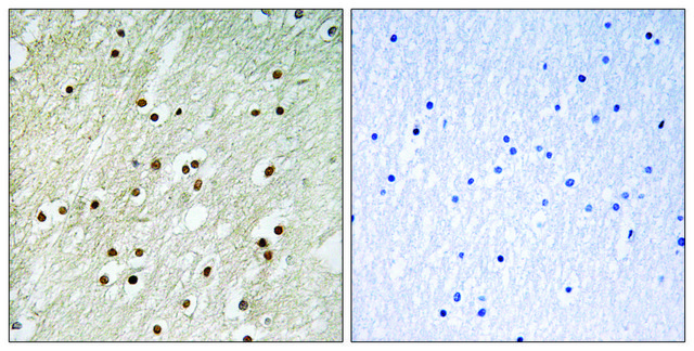 Anti-KU70 antibody produced in rabbit