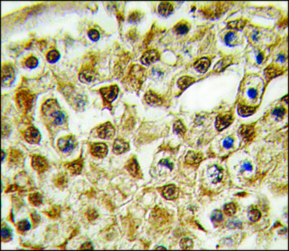 Anti-PARP12 (N-term) antibody produced in