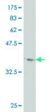 ANTI-LHX1 antibody produced in mouse
