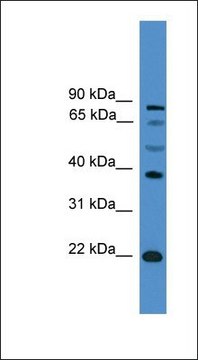 Anti-ASCL2 antibody produced in rabbit
