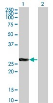 Monoclonal Anti-CDKN1B, (C-terminal) antibody produced