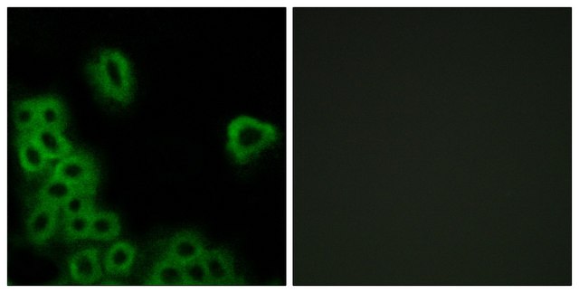Anti-PE2R4 antibody produced in rabbit