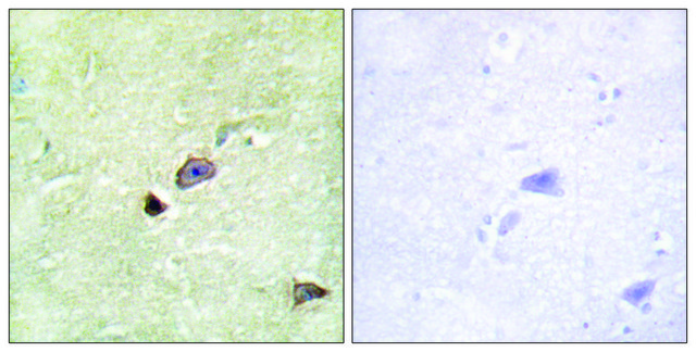 Anti-TRIM59 antibody produced in rabbit