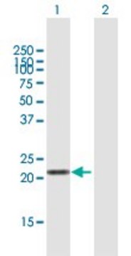 Anti-LVRN antibody produced in mouse