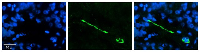 Anti-MTUS1 antibody produced in rabbit