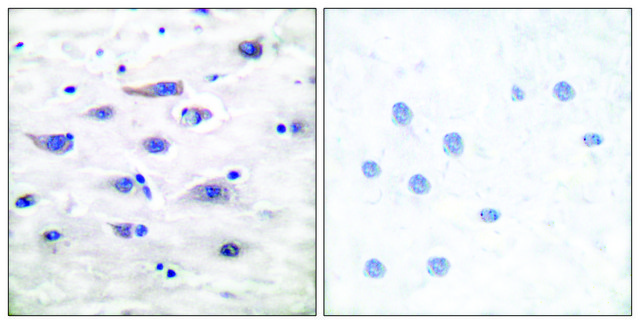 Anti-GLUR1 antibody produced in rabbit
