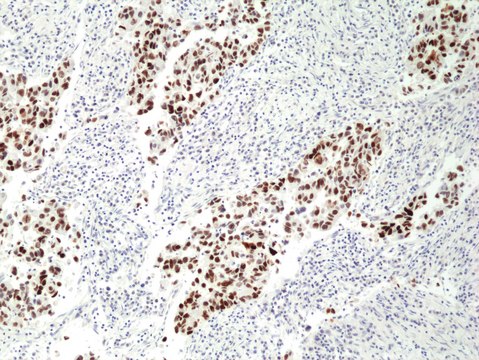Anti-p53 Rabbit Monoclonal Antibody
