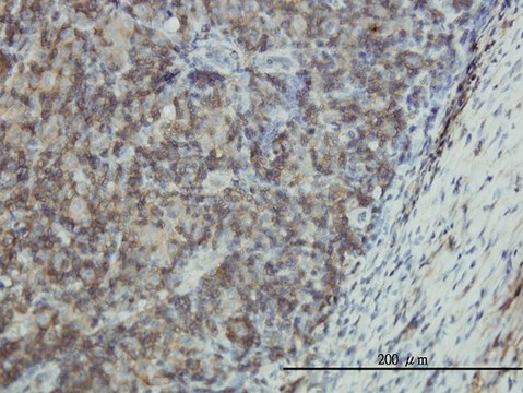 Monoclonal Anti-EMP3 antibody produced in