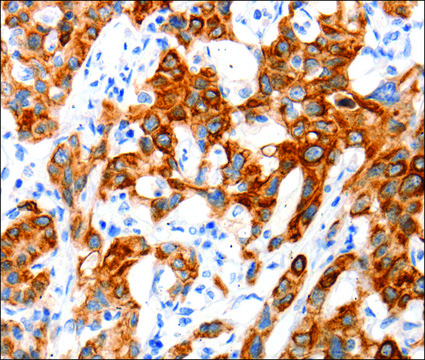 Anti-SLC2A11 antibody produced in rabbit