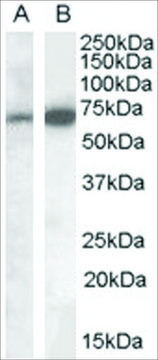 Anti-CADM4 (Internal) antibody produced in