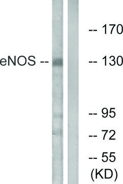 Anti-ENOS antibody produced in rabbit