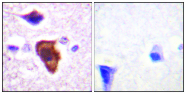 Anti-CD88 antibody produced in rabbit