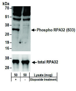 Rabbit anti-Phospho RPA32 (S33) Antibody,