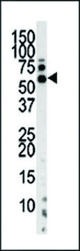 ANTI-PINK1 (PARK6) (N-TERM T133) antibody