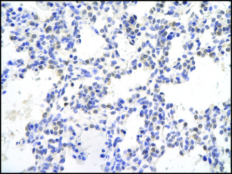 Anti-SMAD4 antibody produced in rabbit