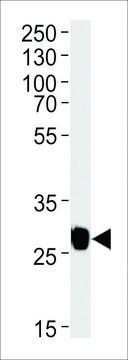 MONOCLONAL ANTI-GFP TAG antibody produced