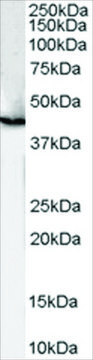 Anti-Cannabinoid receptor 1 antibody produced