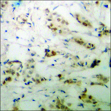 Anti-phospho-p53 (pSer²?) antibody produced in