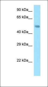 Anti-SNX5 antibody produced in rabbit