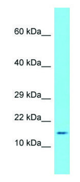 Anti-Saa1 antibody produced in rabbit