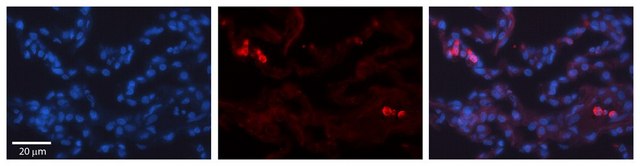 Anti-TRIB1 antibody produced in rabbit