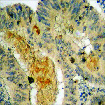 Anti-phospho-IKK-? (pTyr¹??) antibody produced in