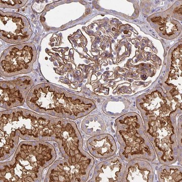 Anti-TNS3 antibody produced in rabbit