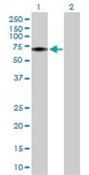 Anti-FLVCR1 antibody produced in rabbit