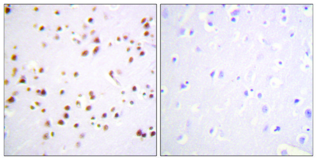 Anti-Catenin-?1 antibody produced in rabbit
