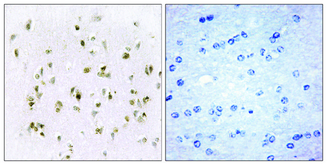 Anti-HMG17 antibody produced in rabbit