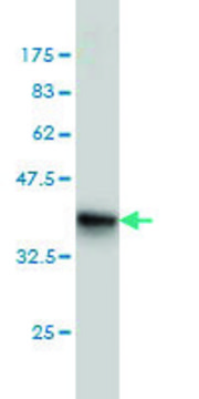 ANTI-FHIT antibody produced in mouse