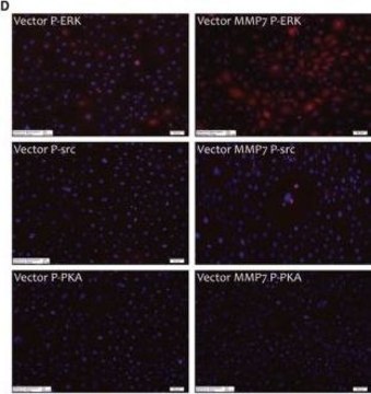 Anti-MMP-7 antibody produced in rabbit