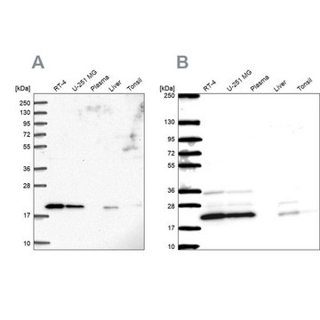 Anti-NDUFAF2 antibody produced in rabbit