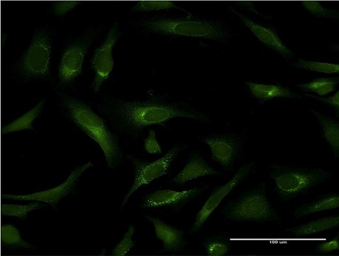 Monoclonal Anti-PIPOX antibody produced in