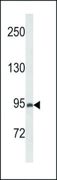 ANTI-PREX1 (CENTER) antibody produced in