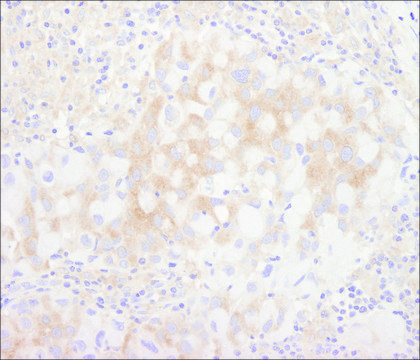 Rabbit anti-BIRC6/Apollon Antibody, Affinity Purified