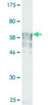 Monoclonal Anti-IL11RA antibody produced in